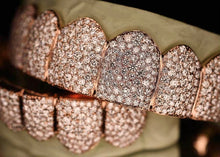 Load image into Gallery viewer, Moissanite Grillz