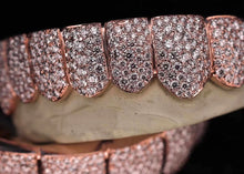 Load image into Gallery viewer, Moissanite Grillz