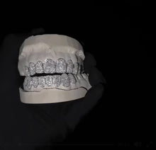 Load and play video in Gallery viewer, Moissanite Grillz
